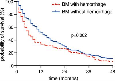 Preoperative Metastatic Brain Tumor-Associated Intracerebral Hemorrhage Is Associated With Dismal Prognosis